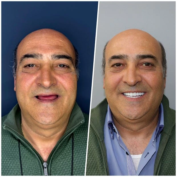 platinum-dental-turismo-dentale-in-albania-2 (1)