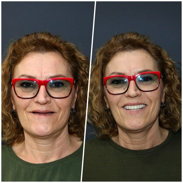 platinum-dental-turismo-dentale-in-albania-3 (1)