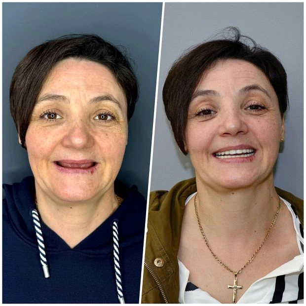 platinum-dental-turismo-dentale-in-albania-9 (1)